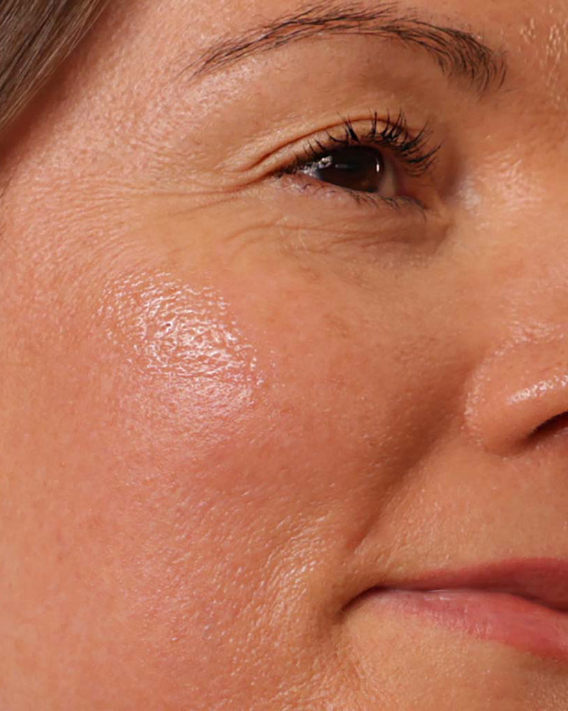 Hyaluron Serum 200